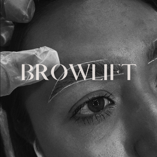 Browlift