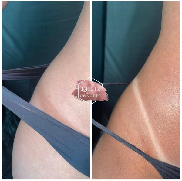 Spray tan