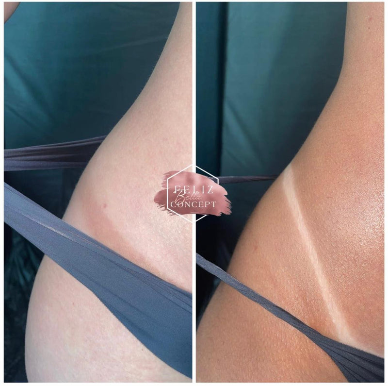 Spray tan