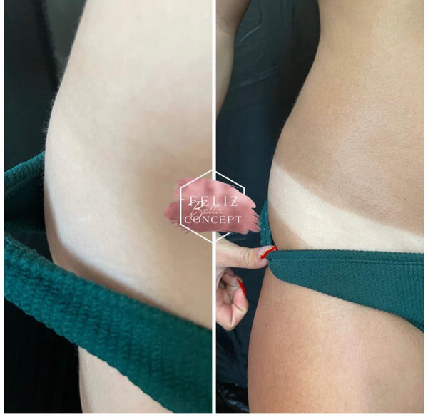 Spray tan